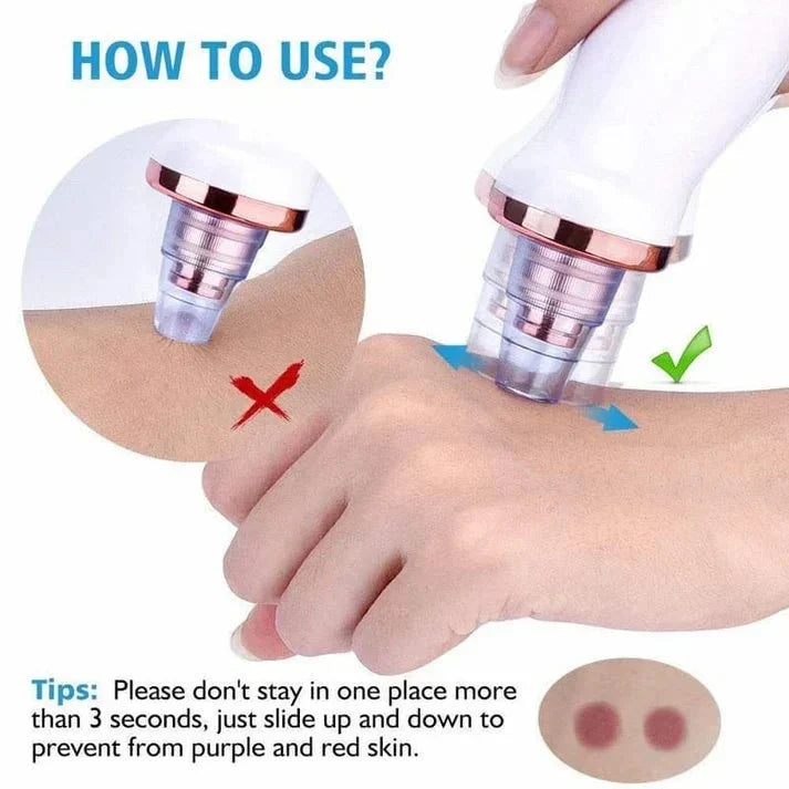 Keep pore vacuum moving